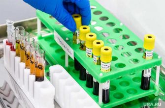 Сколько человек в Тюмени заболели коронавирусом за сутки